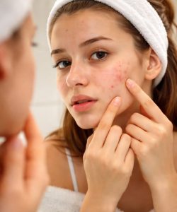 SKIN CONCERNS