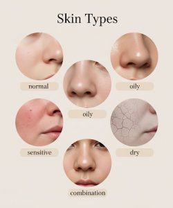 SKIN TYPE